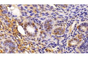 Immunohistochemistry (IHC) image for anti-High Mobility Group Box 1 (HMGB1) (AA 1-215) antibody (ABIN7431743)