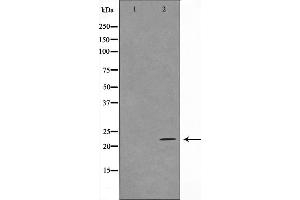 Western blot analysis on HuvEc cell lysate using TFIP8 Antibody,The lane on the left is treated with the antigen-specific peptide. (TNFAIP8 antibody  (Internal Region))