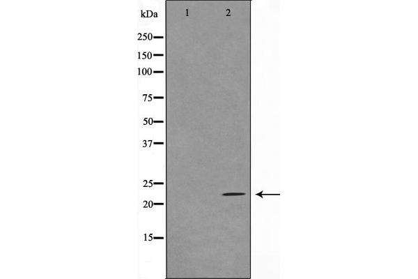 TNFAIP8 antibody  (Internal Region)