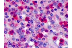 Human Spleen: Formalin-Fixed, Paraffin-Embedded (FFPE) (FPR1 antibody)