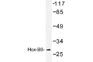 Image no. 1 for anti-Homeobox B9 (HOXB9) antibody (ABIN272173)