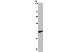Gel: 8 % SDS-PAGE, Lysate: 40 μg, Lane: Mouse skeletal muscle tissue, Primary antibody: ABIN7191867(PHKG1 Antibody) at dilution 1/200, Secondary antibody: Goat anti rabbit IgG at 1/8000 dilution, Exposure time: 1 minute (PHKG1 antibody)
