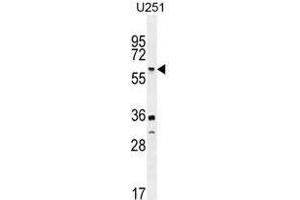 TNFRSF1A Antibody (N-term) western blot analysis in U251 cell line lysates (35 µg/lane). (TNFRSF1A antibody  (N-Term))