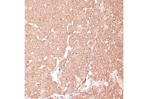 Immunohistochemistry (IHC) image for anti-FERM Domain Containing 6 (FRMD6) (AA 405-614) antibody (ABIN6140773)