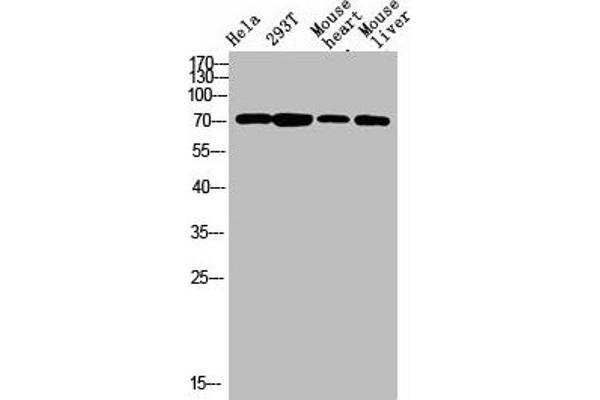 F13B antibody  (Internal Region)