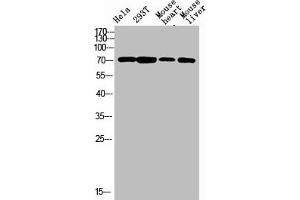 Western blot analysis of varias lysis using F13B antibody.