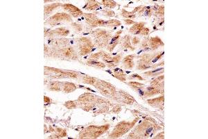 Immunohistochemical analysis of paraffin-embedded H. (PINK1 antibody)