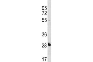 RBPMS antibody western blot analysis in NCI-H460 lysate. (RBPMS antibody  (AA 166-193))