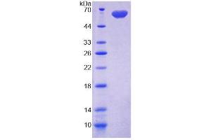 SDS-PAGE analysis of Rat DIO2 Protein.
