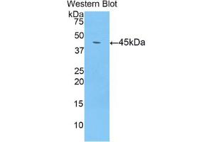 Western blot analysis of the recombinant protein. (LCN8 antibody  (AA 25-176))