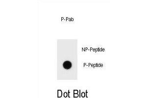 Dot blot analysis of Phospho-bcl-2-S70 Antibody Phospho-specific Pab (ABIN1539712 and ABIN2839909) on nitrocellulose membrane. (Bcl-2 antibody  (pSer70))