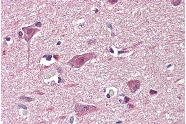 CHD7 antibody  (Internal Region)