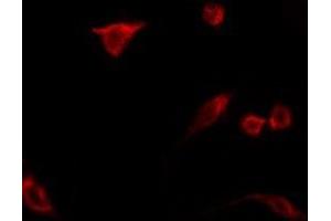 ABIN6275360 staining LOVO by IF/ICC. (N4BP2L2 antibody  (Internal Region))