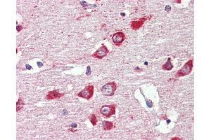 Anti-GABRA3 antibody IHC of human brain, cortex.