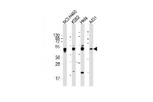 Western Blotting (WB) image for anti-Keratin 18 (KRT18) (AA 401-430), (C-Term) antibody (ABIN391561)