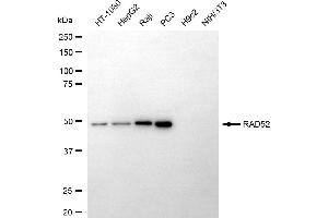 Western blotting analysis using RAD52 antibody (ABIN7800121). (Recombinant RAD52 antibody)
