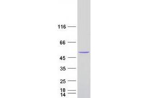 Validation with Western Blot (ARFGAP1 Protein (Transcript Variant 2) (Myc-DYKDDDDK Tag))
