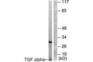 Western blot analysis of extracts from COS7 cells, using TGF alpha Antibody. (TGFA antibody  (AA 111-160))