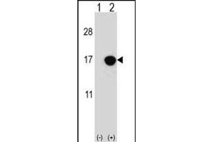 Western blot analysis of CDKN2B (arrow) using rabbit polyclonal CDKN2B Antibody (C-term) (ABIN656561 and ABIN2845822). (CDKN2B antibody  (C-Term))