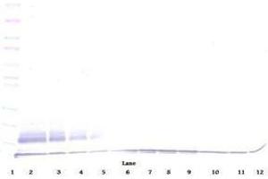 Image no. 3 for anti-Chemokine (C-C Motif) Ligand 22 (CCL22) antibody (ABIN465130) (CCL22 antibody)