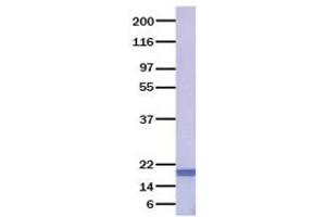 Validation with Western Blot (FGF6 Protein)