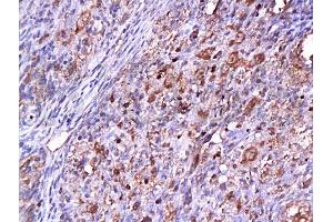 Immunohistochemistry (Paraffin-embedded Sections) (IHC (p)) image for anti-Cyclin-Dependent Kinase 2 (CDK2) (AA 1-100) antibody (ABIN2172819) (CDK2 antibody  (AA 1-100))