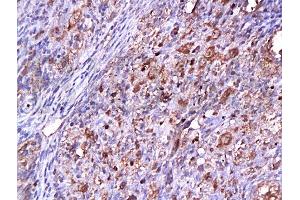 Immunohistochemistry (Paraffin-embedded Sections) (IHC (p)) image for anti-Cyclin-Dependent Kinase 2 (CDK2) (AA 1-100) antibody (ABIN2172819)