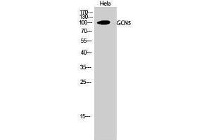 Western Blotting (WB) image for anti-K(lysine) Acetyltransferase 2A (KAT2A) (C-Term) antibody (ABIN3184765) (KAT2A antibody  (C-Term))