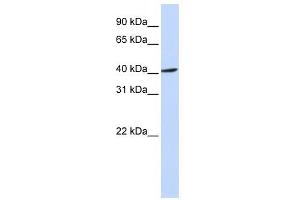 FBXO28 antibody used at 1 ug/ml to detect target protein.