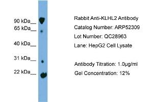 WB Suggested Anti-KLHL2  Antibody Titration: 0. (KLHL2 antibody  (Middle Region))