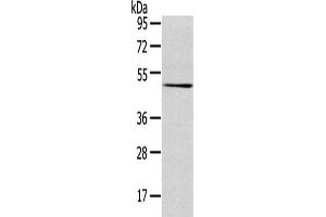 Gel: 8 % SDS-PAGE,Lysate: 40 μg,Primary antibody: ABIN7131404(TMPRSS4 Antibody) at dilution 1/500 dilution,Secondary antibody: Goat anti rabbit IgG at 1/8000 dilution,Exposure time: 3 minutes (TMPRSS4 antibody)