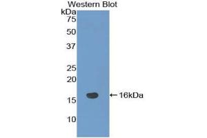 Western blot analysis of the recombinant protein. (NRARP antibody  (AA 3-109))