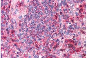 Human Spleen (formalin-fixed, paraffin-embedded) stained with TRAF6 antibody ABIN214305 at 2.