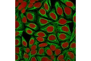 Confocal immunofluorescence image of HeLa cells using Cytokeratin 18 Mouse Monoclonal Antibody (KRT18/1190). (Cytokeratin 18 antibody)