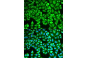 Immunofluorescence analysis of U2OS cells using WAS antibody. (WASP antibody  (AA 60-250))