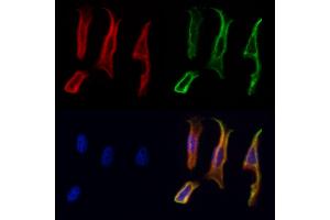 ABIN6264672 and ABIN6278514 staining Hela cells by IF/ICC.