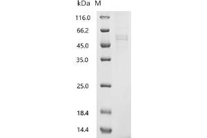 (Tris-Glycine gel) Discontinuous SDS-PAGE (reduced) with 5 % enrichment gel and 15 % separation gel.