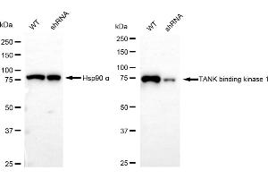 Western blotting analysis using TANK binding kinase 1 antibody (ABIN7800507).