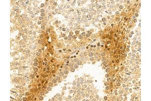 ABIN6265516 and ABIN6272982 at 1/100 staining Rat testis tissue by IHC-P.