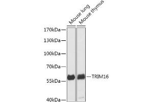 Western blot analysis of extracts of various cell lines, using TRIM16 antibody (ABIN7270978) at 1:1000 dilution.