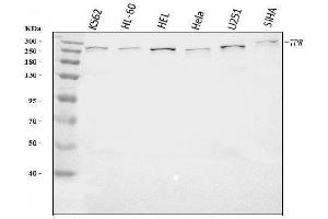 Western blot analysis of TPR using anti-TPR antibody (ABIN7603243).
