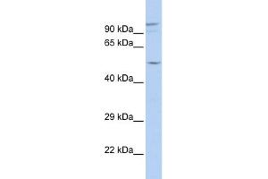 WB Suggested Anti-GJA3 Antibody Titration:  0.