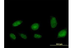 Immunofluorescence of purified MaxPab antibody to ATAD2 on HeLa cell. (ATAD2 antibody  (AA 1-362))
