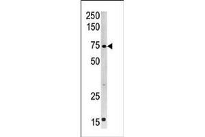 Image no. 1 for anti-Carnitine Palmitoyltransferase 2 (CPT2) (C-Term) antibody (ABIN357771)