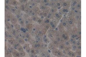 Detection of ITGb5 in Mouse Liver Tissue using Polyclonal Antibody to Integrin Beta 5 (ITGb5) (Integrin beta 5 antibody  (AA 136-378))