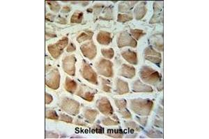 Calponin-3 Antibody (Center) (ABIN390504 and ABIN2840860) IHC analysis in formalin fixed and paraffin embedded human skeletal muscle tissue followed by peroxidase conjugation of the secondary antibody and DAB staining. (CNN3 antibody  (AA 129-158))