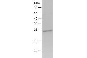 Western Blotting (WB) image for Glutathione S-Transferase alpha 1 (GSTA1) (AA 1-222) protein (His tag) (ABIN7123136) (GSTA1 Protein (AA 1-222) (His tag))