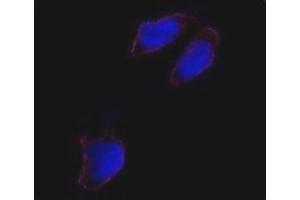 Immunofluorescence analysis of Oct4 antibody and HeLa cells. (OCT4 antibody  (AA 1-30))