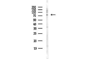 anti-B-Cell CLL/lymphoma 6 (BCL6) (Internal Region) antibody