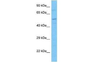 Host:  Rabbit  Target Name:  MP2K7  Sample Type:  293T Whole Cell lysates  Antibody Dilution:  1. (MP2K7 antibody  (C-Term))
